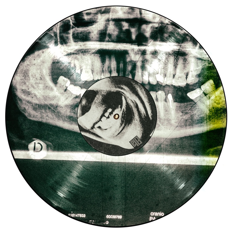 Rx Panoramica dentale su copertina LP Musica Jazz, Ella Fitzgerald (disco fuori commercio)